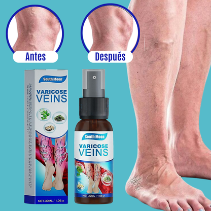 VARICOSE VEINS | TRATAMIENTO PARA VARICES 2x1 – RESULTADOS EN 7 DIAS