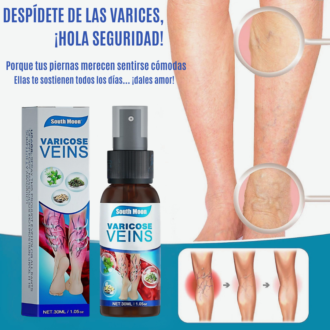 VARICOSE VEINS | TRATAMIENTO PARA VARICES 2x1 – RESULTADOS EN 7 DIAS
