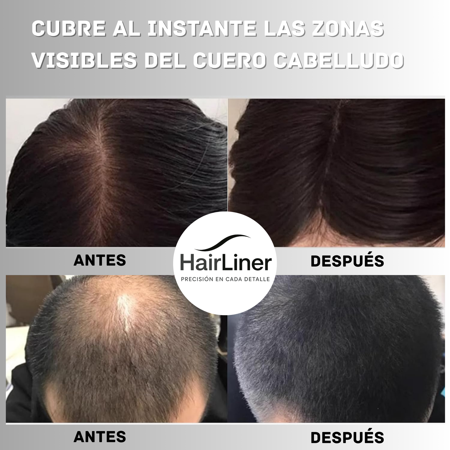 HAIRLINER | CONFIANZA QUE SE NOTA