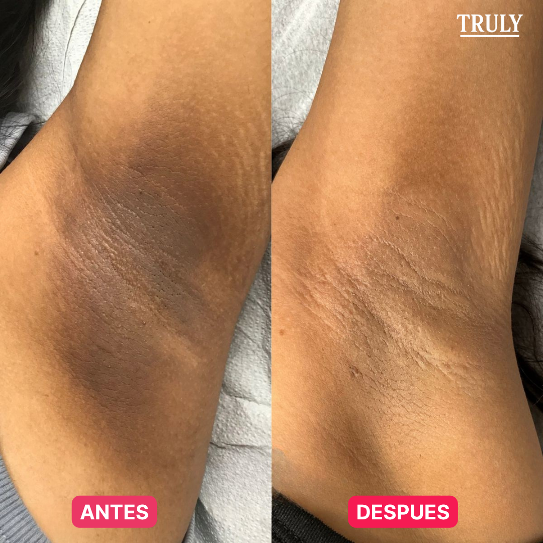 TRULY | TRATAMIENTO ANTI-MANCHAS 7 DÍAS 100% NATURAL
