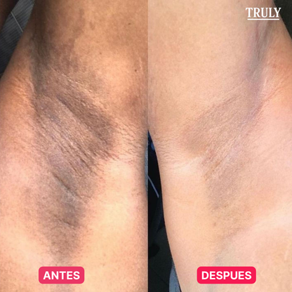 TRULY | TRATAMIENTO ANTI-MANCHAS 7 DÍAS 100% NATURAL